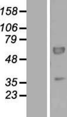 Western Blot PEX16 Overexpression Lysate