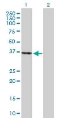 Western Blot: PEX26 Antibody [H00055670-B01P] - Analysis of PEX26 expression in transfected 293T cell line by PEX26 polyclonal antibody.  Lane 1: PEX26 transfected lysate(33.55 KDa). Lane 2: Non-transfected lysate.