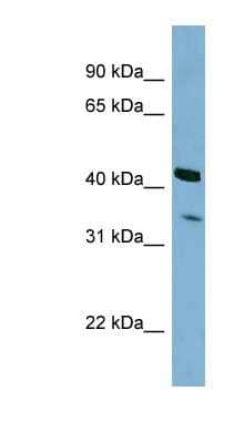 Western Blot: PEX26 Antibody [NBP1-55114] - Titration: 0.2-1 ug/ml, Positive Control: HepG2 cell lysate.