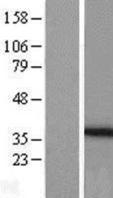 Western Blot PEX26 Overexpression Lysate
