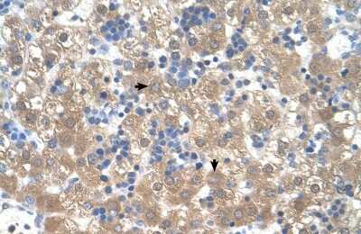 Immunohistochemistry-Paraffin: PEX3 Antibody [NBP1-52960] - Human Liver Tissue, antibody concentration 4-8ug/ml. Cells with positive label: Hepatocytes (indicated with arrows) 400X magnification.