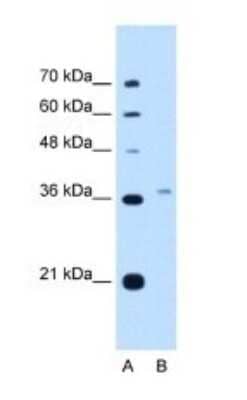 Western Blot: PEX3 Antibody [NBP1-52960] - Titration: 5.0ug/ml Positive Control: HepG2 cell lysate.