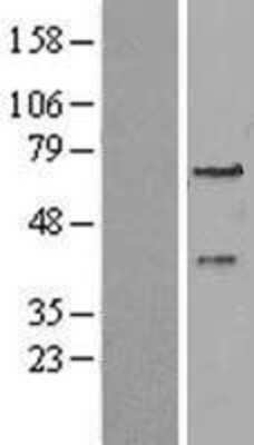 Western Blot PEX3 Overexpression Lysate