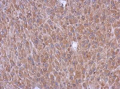 Immunohistochemistry-Paraffin: PEX5 Antibody [NBP2-19781] - Immunohistochemical analysis of paraffin-embedded U87 xenograft, using antibody at 1:500 dilution.