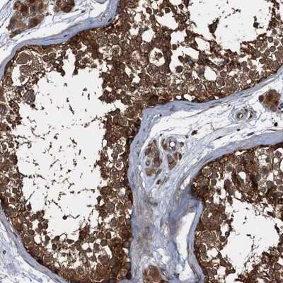 Immunohistochemistry-Paraffin: PEX5 Antibody [NBP2-38443] - Staining of human testis shows high expression.