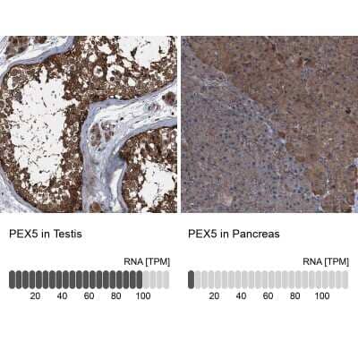 <b>Independent Antibodies Validation and Orthogonal Strategies Validation.</b>Immunohistochemistry-Paraffin: PEX5 Antibody [NBP2-38443] - Staining in human testis and pancreas tissues using anti-PEX5 antibody. Corresponding PEX5 RNA-seq data are presented for the same tissues.