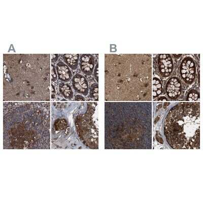 <b>Independent Antibodies Validation. </b>Immunohistochemistry-Paraffin: PEX5 Antibody [NBP2-38443] - Staining of human cerebral cortex, colon, lymph node and testis using Anti-PEX5 antibody NBP2-38443 (A) shows similar protein distribution across tissues to independent antibody NBP1-87185 (B).