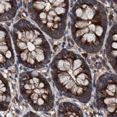 Immunohistochemistry-Paraffin: PEX5 Antibody [NBP2-38443] - Staining of human colon.