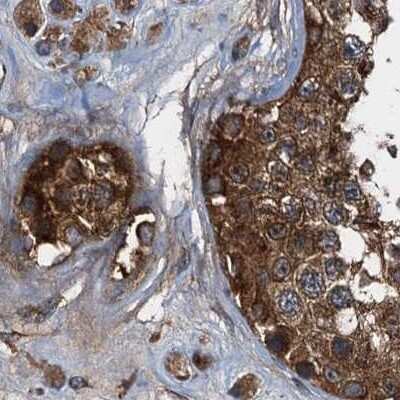 Immunohistochemistry-Paraffin: PEX5 Antibody [NBP2-38443] - Staining of human testis using Anti-PEX5 antibody NBP2-38443.