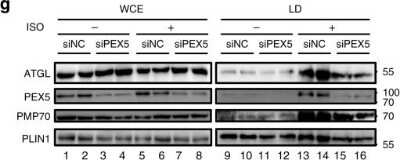 <b>Genetic Strategies Validation. </b>Knockdown Validated: PEX5 Antibody [NBP2-38443] - PEX5 escorts ATGL to LD to mediate fasting-induced lipolysis. Western blot of whole cell extracts (WCE) or LD fractionation from adipocytes transfected with siNC or siPEX5. 30 ug of protein from WCE; 20 ug of protein from LD fraction. Image collected and cropped by CiteAb from the following publication (//www.nature.com/articles/s41467-019-14176-0), licensed under a CC-BY license.