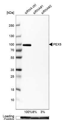 <b>Genetic Strategies Validation. </b>Western Blot: PEX5 Antibody [NBP2-38443] - Analysis in U2OS cells transfected with control siRNA, target specific siRNA probe #1 and #2, using Anti-PEX5 antibody. Remaining relative intensity is presented. Loading control: Anti-GAPDH.