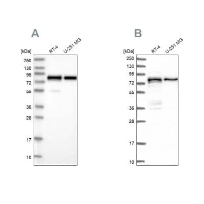 Western Blot: PEX5 Antibody [NBP2-38443] - Analysis using Anti-PEX5 antibody NBP2-38443 (A) shows similar pattern to independent antibody NBP1-87185 (B).