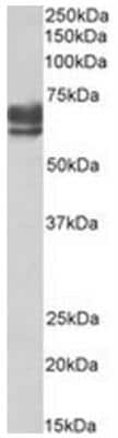 Western Blot: PEX5 Antibody [NBP2-44324] - Analysis of Human Kidney lysate (35ug protein in RIPA buffer).