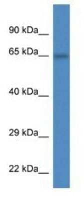 Western Blot PEX5L Antibody