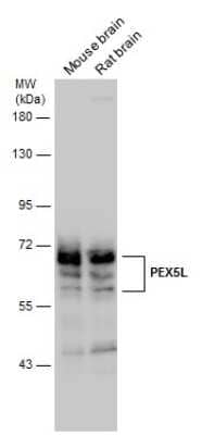 Western Blot PEX5L Antibody