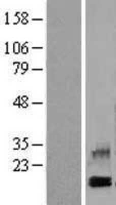 Western Blot CXCL4/PF4 Overexpression Lysate