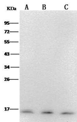 Western Blot: PFDN1 Antibody (12) [NBP3-06609] - Lane A: 293T Whole Cell Lysate Lane B: Hela Whole Cell Lysate Lane C: Jurkat Whole Cell Lysate Lysates/proteins at 30 ug per lane. Secondary Rabbit Anti-Mouse IgG F(ab) 2/HRP at 1/10000 dilution. Developed using the ECL technique.Performed under reducing conditions. Predicted band size:14 kDa Observed band size:14 kDa