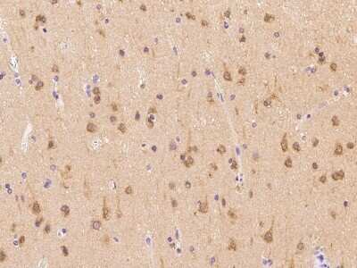 Immunohistochemistry-Paraffin: PFDN1 Antibody [NBP2-97905] - Immunochemical staining of human PFDN1 in human brain with rabbit polyclonal antibody at 1:300 dilution, formalin-fixed paraffin embedded sections.