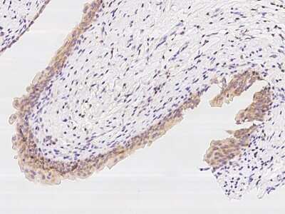 Immunohistochemistry-Paraffin: PFDN1 Antibody [NBP2-97905] - Immunochemical staining of human PFDN1 in human urinary bladder with rabbit polyclonal antibody at 1:300 dilution, formalin-fixed paraffin embedded sections.