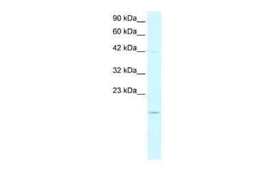 Western Blot: PFDN1 Antibody [NBP2-83384] - WB Suggested Anti-PFDN1 Antibody Titration: 5.0-8.0ug/ml. Positive Control: HepG2 cell lysatePFDN1 is supported by BioGPS gene expression data to be expressed in HepG2