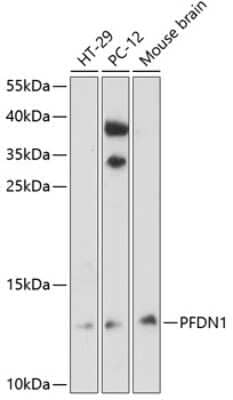 Western Blot: PFDN1 Antibody [NBP2-94786] - Analysis of extracts of various cell lines, using PFDN1 . Exposure time: 30s.