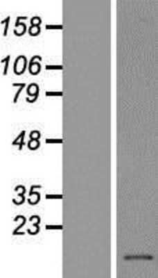 Western Blot: PFDN1 Overexpression Lysate (Adult Normal) [NBL1-14306] Left-Empty vector transfected control cell lysate (HEK293 cell lysate); Right -Over-expression Lysate for PFDN1.