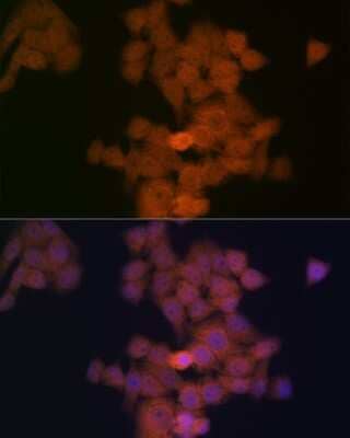 Immunocytochemistry/Immunofluorescence: PFDN5 Antibody (9Y5H7) [NBP3-16331] - Immunofluorescence analysis of HeLa cells using PFDN5 Rabbit mAb (NBP3-16331) at dilution of 1:100 (40x lens). Blue: DAPI for nuclear staining.