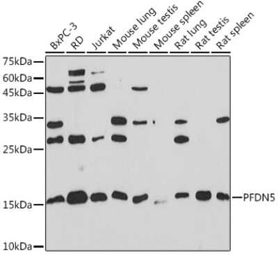 Western Blot: PFDN5 Antibody (9Y5H7) [NBP3-16331] - Western blot analysis of extracts of various cell lines, using PFDN5 Rabbit mAb (NBP3-16331) at 1:1000 dilution. Secondary antibody: HRP Goat Anti-Rabbit IgG (H+L) at 1:10000 dilution. Lysates/proteins: 25ug per lane. Blocking buffer: 3% nonfat dry milk in TBST. Detection: ECL Basic Kit. Exposure time: 180s.