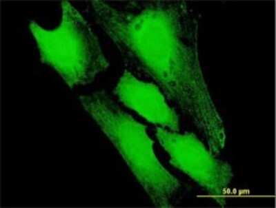 Immunocytochemistry/Immunofluorescence: PFDN5 Antibody [H00005204-B03P] - Analysis of purified antibody to PFDN5 on HeLa cell. Antibody concentration 10 ug/ml