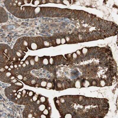 Immunohistochemistry-Paraffin: PFDN5 Antibody [NBP1-82639] - Staining of human small intestine shows strong cytoplasmic and membrane positivity in glandular cells.