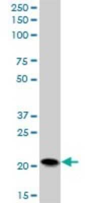 Western Blot: PFDN5 Antibody [H00005204-B03P] - Analysis of PFDN5 expression in human pancreas.