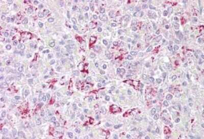 Immunohistochemistry-Paraffin PFKFB2 Antibody