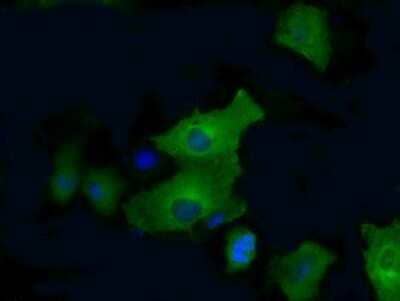 Immunocytochemistry/Immunofluorescence: PFKFB4 Antibody (OTI1C8) - Azide and BSA Free [NBP2-73340] - Staining of COS7 cells transiently transfected by pCMV6-ENTRY PFKFB4.