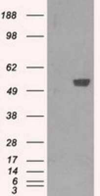 Western Blot: PFKFB4 Antibody (OTI1C8) - Azide and BSA Free [NBP2-73340] - HEK293T cells were transfected with the pCMV6-ENTRY control (Left lane) or pCMV6-ENTRY PFKFB4 (Right lane) cDNA for 48 hrs and lysed. Equivalent amounts of cell lysates (5 ug per lane) were separated by SDS-PAGE and immunoblotted with anti-PFKFB4.