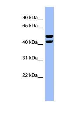 Western Blot: PFKFB4 Antibody [NBP1-57620] - HepG2 cell lysate, concentration 0.2-1 ug/ml.