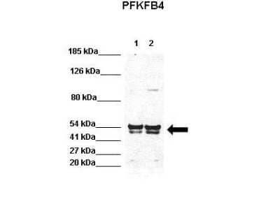 Western Blot: PFKFB4 Antibody [NBP1-57620] - Positive control: Lane 1 : 40ug HEK293 lysate Lane 2: 40ug H1299 lysate Primary, Antibody Dilution: 1 : 1000 Secondary Antibody: Goat anti-rabbit-HRP Secondry, Antibody Dilution: 1 : 5000.