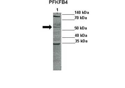 Western Blot: PFKFB4 Antibody [NBP1-57620] - Positive control: Lane1 : 10ug human Primary tumor lysate Primary, Antibody Dilution: 1 : 1000 Secondary Antibody: Anti-rabbit-HRP Secondry, Antibody Dilution: 1 : 5000.