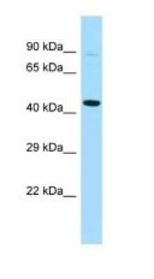 Western Blot: PFKFB4 Antibody [NBP1-98575] - Titration: 1.0 ug/ml Positive Control: Mouse Heart.