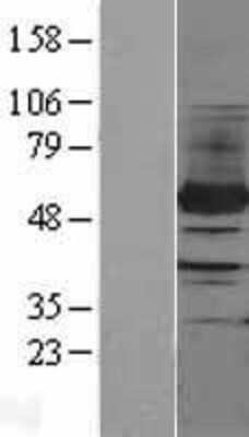 Western Blot: PFKFB4 Overexpression Lysate (Adult Normal) [NBL1-14313] Left-Empty vector transfected control cell lysate (HEK293 cell lysate); Right -Over-expression Lysate for PFKFB4.
