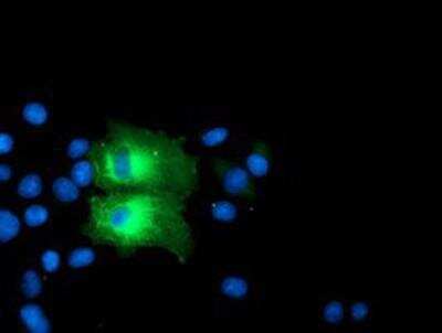 <b>Genetic Strategies Validation. </b>Immunocytochemistry/Immunofluorescence: PFKP Antibody (OTI1D6) [NBP2-01539] - Staining of COS7 cells transiently transfected by pCMV6-ENTRY PFKP.