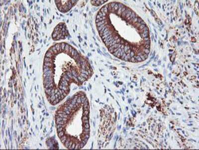 Immunohistochemistry-Paraffin: PFKP Antibody (1D6) [NBP2-01539] - Staining of paraffin-embedded Human endometrium tissue using anti-PFKP mouse monoclonal antibody.