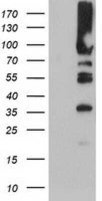 Western Blot: PFKP Antibody (1D6) [NBP2-01539] - HEK293T cells were transfected with the pCMV6-ENTRY control (Left lane) or pCMV6-ENTRY PFKP (Right lane) cDNA for 48 hrs and lysed. Equivalent amounts of cell lysates (5 ug per lane) were separated by SDS-PAGE and immunoblotted with anti-PFKP.