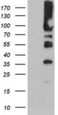 Western Blot: PFKP Antibody (OTI1D6) - Azide and BSA Free [NBP2-73344] - HEK293T cells were transfected with the pCMV6-ENTRY control (Left lane) or pCMV6-ENTRY PFKP (Right lane) cDNA for 48 hrs and lysed. Equivalent amounts of cell lysates (5 ug per lane) were separated by SDS-PAGE and immunoblotted with anti-PFKP.