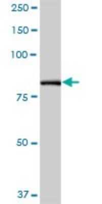 Western Blot: PFKP Antibody [H00005214-B01P] - Analysis of PFKP expression in human pancreas.