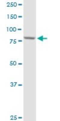 Western Blot: PFKP Antibody [H00005214-D01P] - Analysis of PFKP expression in Jurkat.