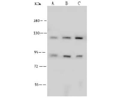 Western Blot: PFKP Antibody [NBP2-99101] - Anti-PFKP rabbit polyclonal antibody at 1:500 dilution. Lane A: MCF7 Whole Cell Lysate Lane B: HeLa Whole Cell Lysate Lane C: Jurkat Whole Cell Lysate Lysates/proteins at 30 ug per lane. Secondary Goat Anti-Rabbit IgG (H+L)/HRP at 1/10000 dilution. Developed using the ECL technique. Performed under reducing conditions. Predicted band size: 86 kDa