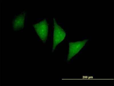 Immunocytochemistry/Immunofluorescence: PFTK1 Antibody [H00005218-B01P] - Analysis of purified antibody to PFTK1 on HeLa cell. (antibody concentration 10 ug/ml)