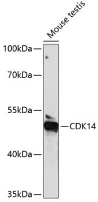 Immunohistochemistry-Paraffin: PFTK1 Antibody [NBP3-03671] - Analysis of extracts of mouse testis, using PFTK1 antibody at 1:1000 dilution. Secondary antibody: HRP Goat Anti-Rabbit IgG (H+L) at 1:10000 dilution. Lysates/proteins: 25ug per lane. Blocking buffer: 3% nonfat dry milk in TBST. Detection: ECL Basic Kit .