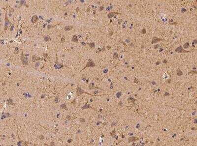 Immunohistochemistry-Paraffin: PFTK1 Antibody [NBP3-06062] - Immunochemical staining of human PFTK1 in human brain with rabbit polyclonal antibody at 1:100 dilution, formalin-fixed paraffin embedded sections.