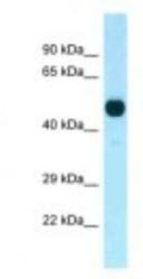 Western Blot: PFTK1 Antibody [NBP1-98270] - Mouse Pancreas Lysate 1.0ug/ml, Gel Concentration: 12%